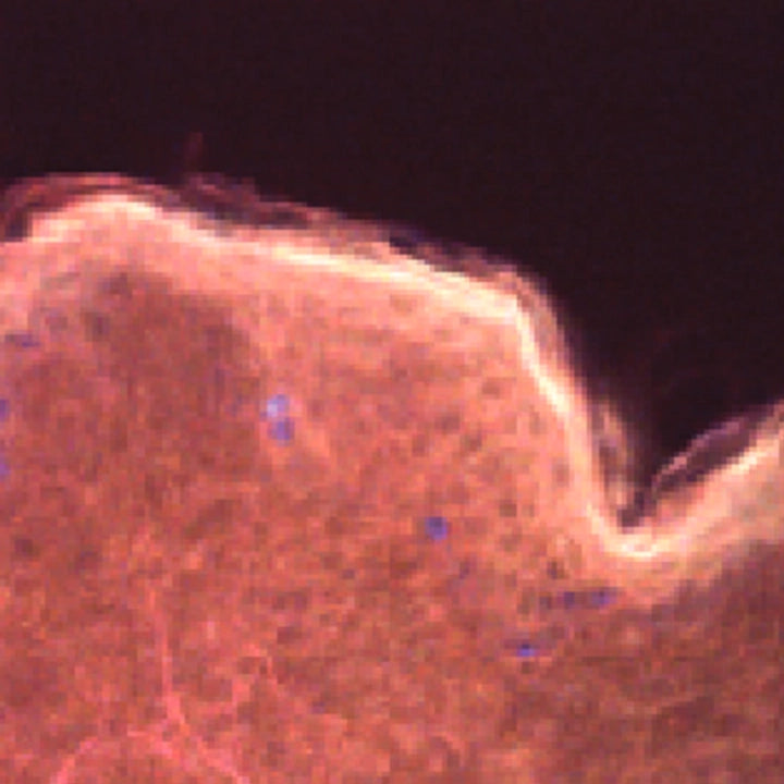 Fluorescence image of human skin after 15 minutes in 1.9 M magnesium chloride, showing bright signal