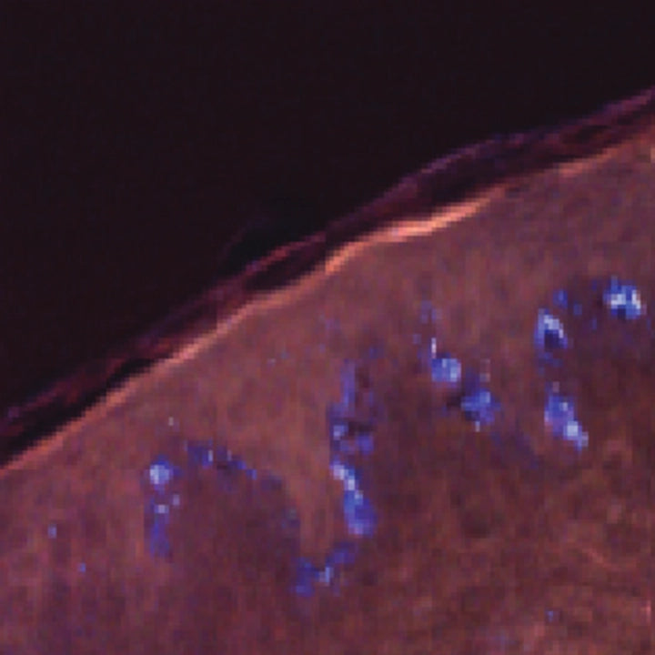 Fluorescence image of human skin after 15 minutes in 52 mM magnesium chloride, showing low signal