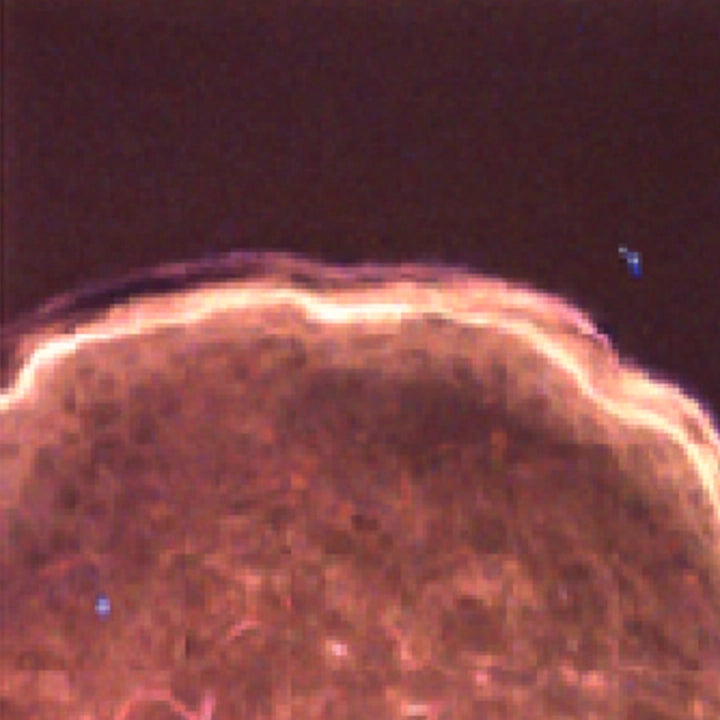 Fluorescence image of human skin after 30 minutes in magnesium solution, with bright signal into the tissue