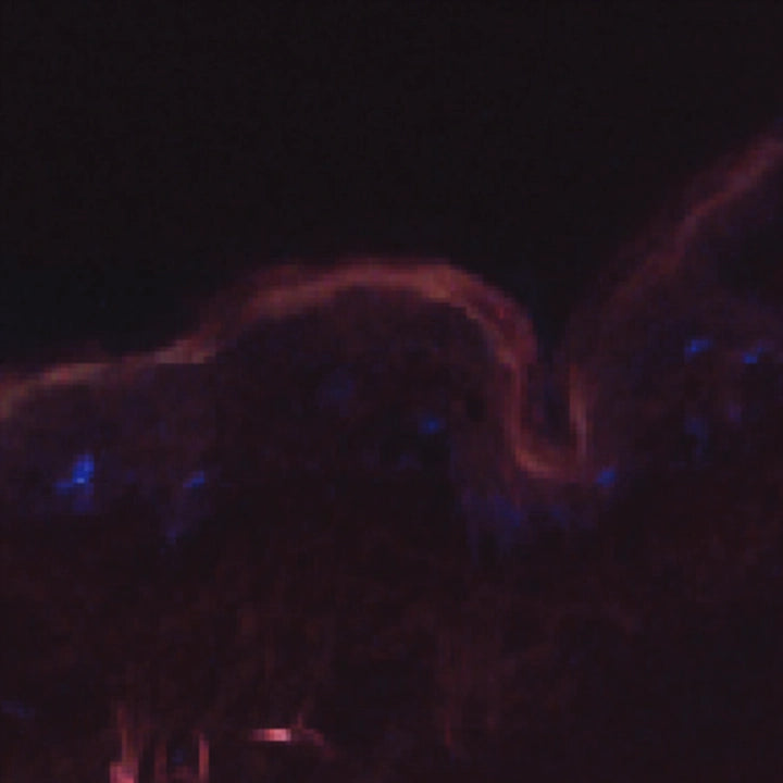 Fluorescence image of untreated human skin showing little magnesium signal