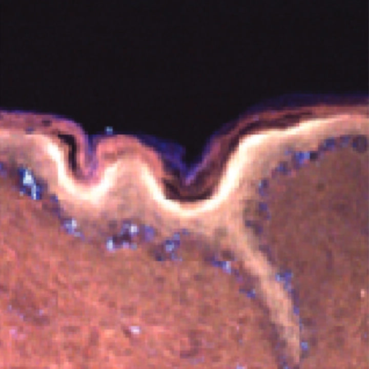 Fluorescence image of human skin after 60 minutes in 52 mM magnesium chloride, showing bright signal