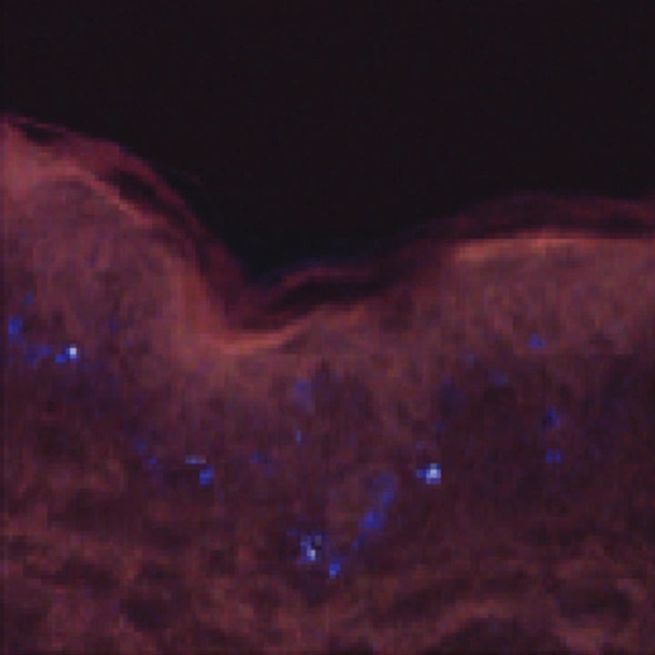 Fluorescence image of human skin after 5 minutes in 52 mM magnesium chloride, showing little signal